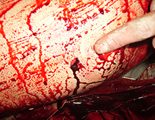 Ngaba Killed Protester